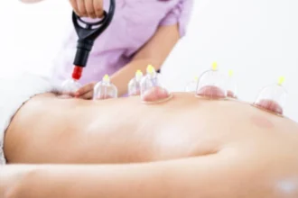 What is Hijama